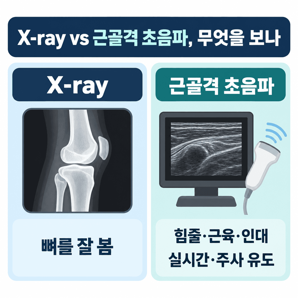 X-ray와 근골격 초음파가 각각 무엇을 보는지 비교한 안내 카드